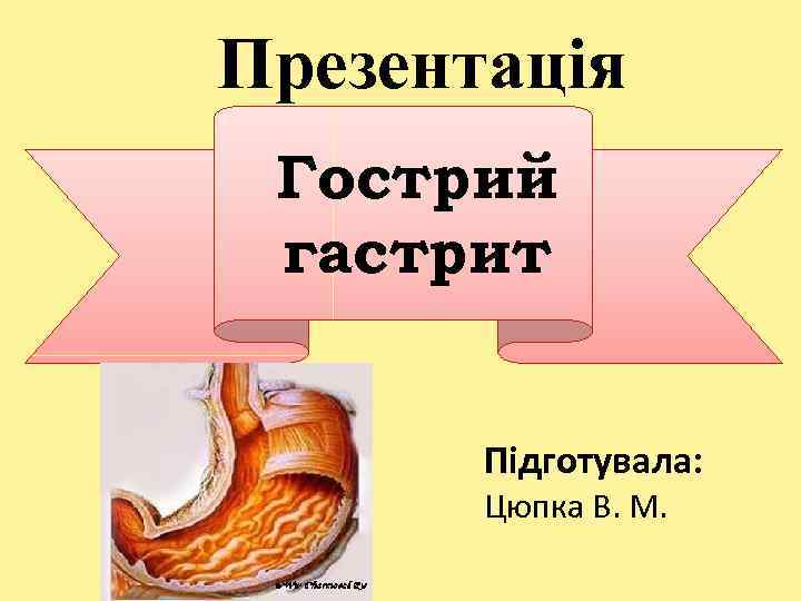 Презентація Гострий гастрит Підготувала: Цюпка В. М. 