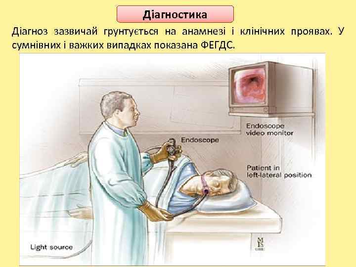 Діагностика Діагноз зазвичай грунтується на анамнезі і клінічних проявах. У сумнівних і важких випадках