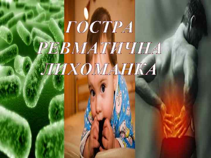 ГОСТРА РЕВМАТИЧНА ЛИХОМАНКА 