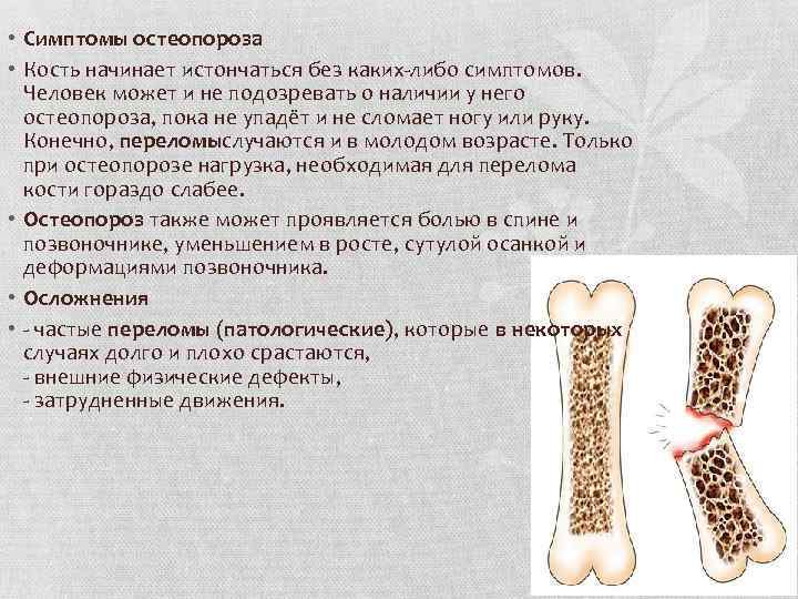 Костей начало. Симптомы остеопороза костей ступни. Остеопороз ступни симптомы. У женщин истончаются кости. Почему кости начинают хрипеть.