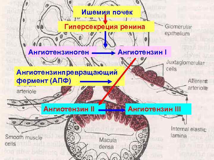 Ишемия почек Гиперсекреция ренина Ангиотензиноген Ангиотензин I Ангиотензинпревращающий фермент (АПФ) Ангиотензин III 