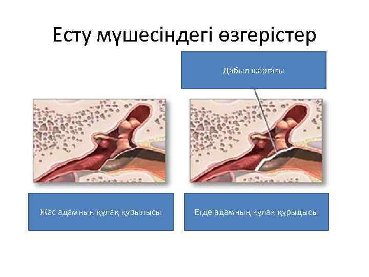 Есту мүшесіндегі өзгерістер Дабыл жарғағы Жас адамның құлақ құрылысы Егде адамның құлақ құрыдысы 