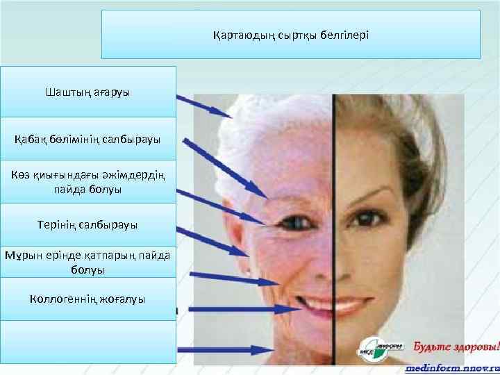 Қартаюдың сыртқы белгілері Шаштың ағаруы Қабақ бөлімінің салбырауы Көз қиығындағы әжімдердің пайда болуы Терінің