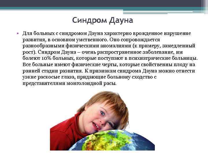 Синдром Дауна • Для больных с синдромом Дауна характерно врожденное нарушение развития, в основном