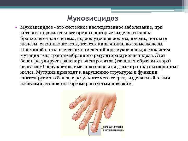 Муковисцидоз • Муковисцидоз - это системное наследственное заболевание, при котором поражаются все органы, которые