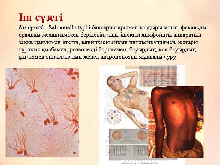 Іш сүзегі – Salmonella typhi бактерияларымен қоздырылатын, фекальдыоральды механизмімен берілетін, ащы ішектің лимфоидты аппаратын