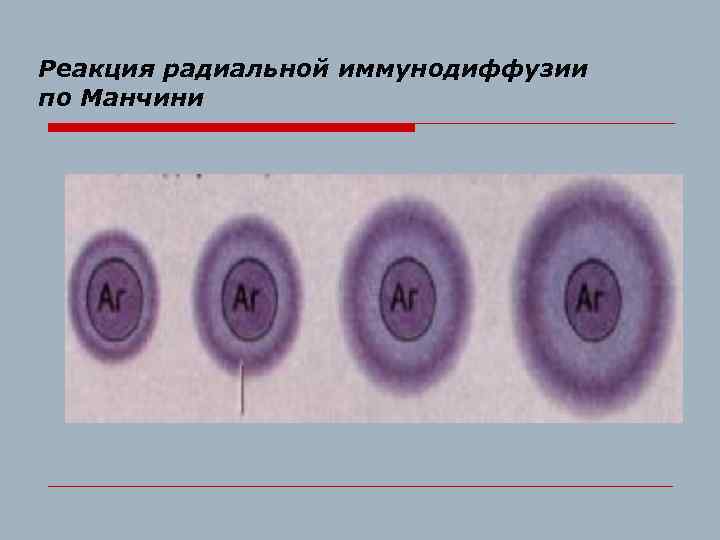 Реакция радиальной иммунодиффузии по Манчини 