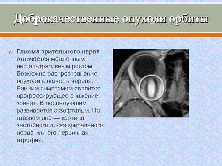 Доклад: Компьютерная термография в диагностике злокачественных опухолей глаза и орбиты