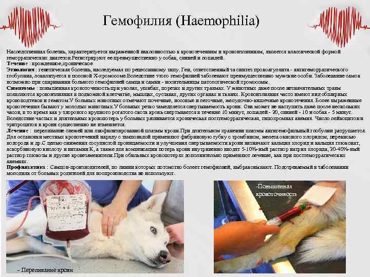 Гемофилия (Haemophilia) Наследственная болезнь, характеризуется выраженной наклонностью к кровотечениям и кровоизлияниям, является классической формой