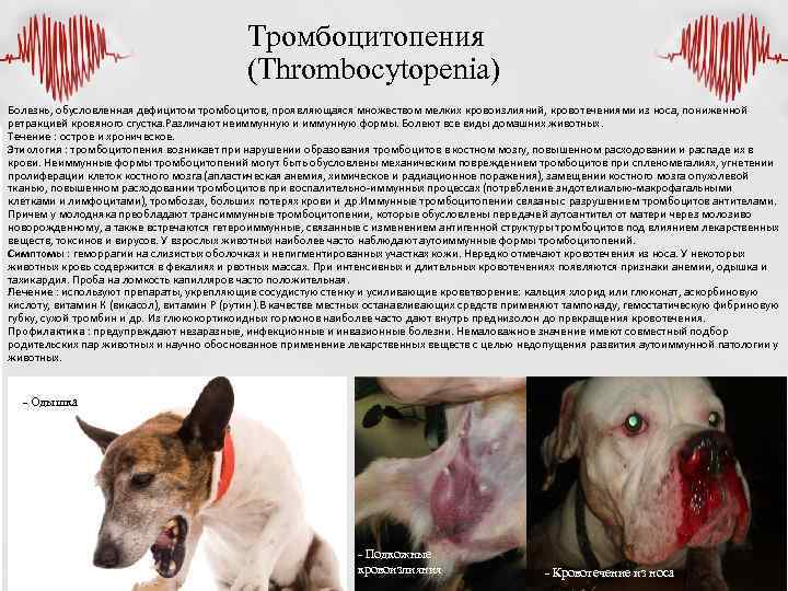 Тромбоцитопения (Thrombocytopenia) Болезнь, обусловленная дефицитом тромбоцитов, проявляющаяся множеством мелких кровоизлияний, кровотечениями из носа, пониженной