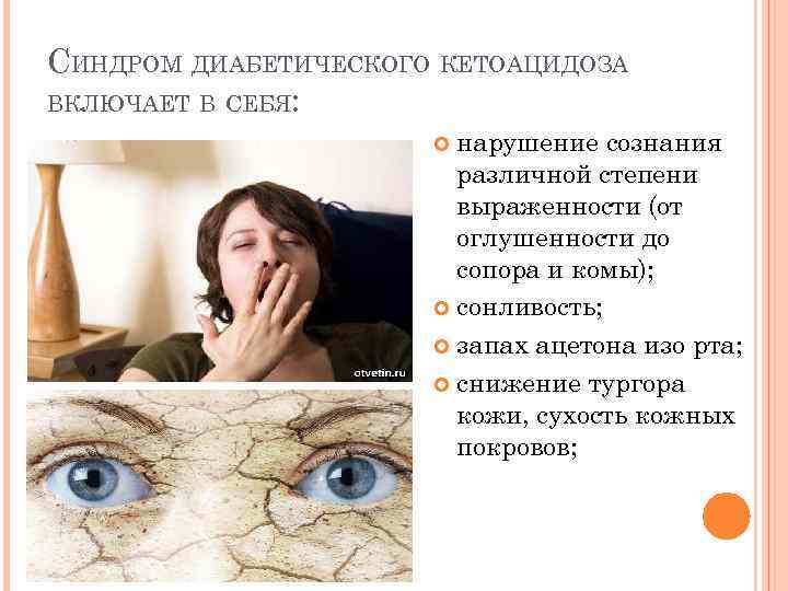 СИНДРОМ ДИАБЕТИЧЕСКОГО КЕТОАЦИДОЗА ВКЛЮЧАЕТ В СЕБЯ: нарушение сознания различной степени выраженности (от оглушенности до