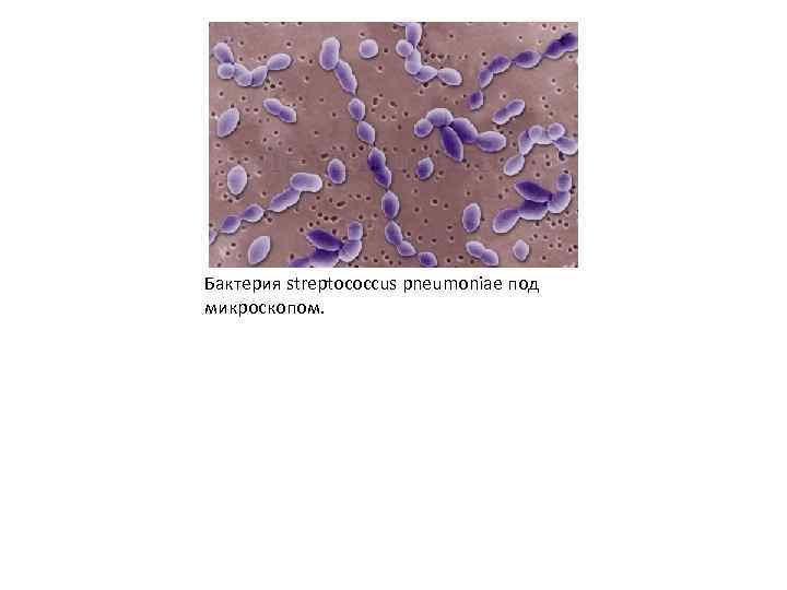 Бактерия streptococcus pneumoniae под микроскопом. 