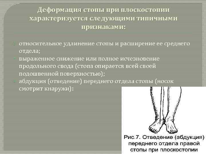 Деформация стопы при плоскостопии характеризуется следующими типичными признаками: относительное удлинение стопы и расширение ее