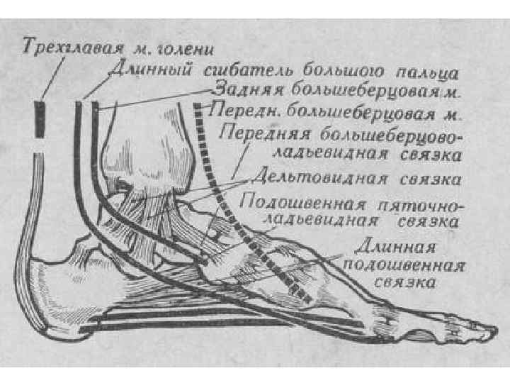 Презентация перелом лодыжек