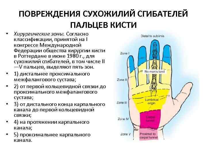 Повреждения сухожилий кисти презентация