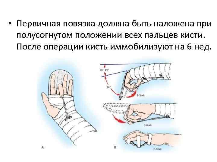 Карта вызова травматическая ампутация фаланги пальца