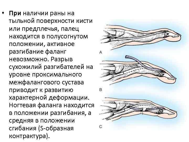 Тыльная сторона кисти фото