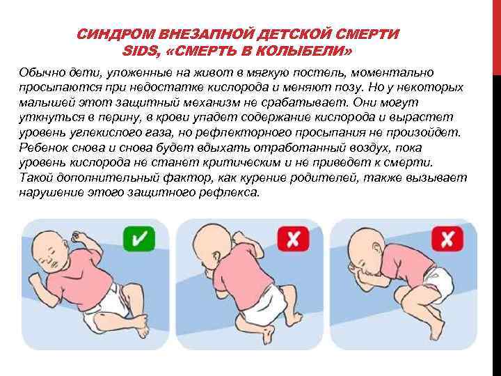 СИНДРОМ ВНЕЗАПНОЙ ДЕТСКОЙ СМЕРТИ SIDS, «СМЕРТЬ В КОЛЫБЕЛИ» Обычно дети, уложенные на живот в