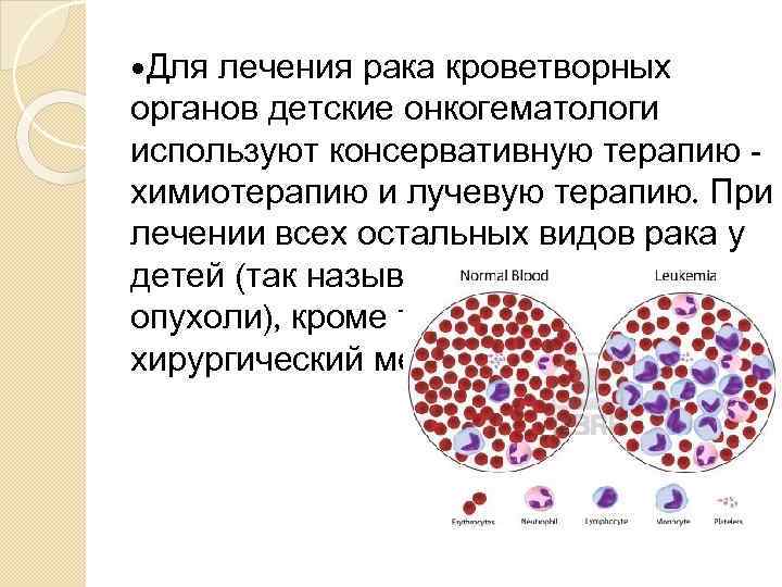  Для лечения рака кроветворных органов детские онкогематологи используют консервативную терапию химиотерапию и лучевую