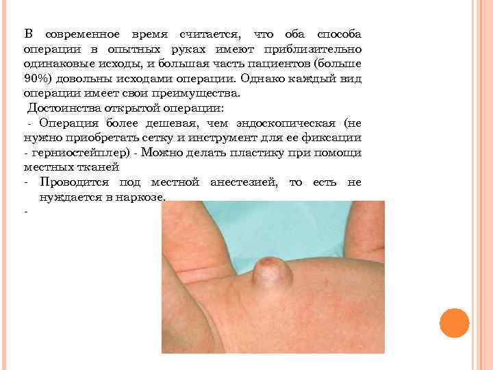 В современное время считается, что оба способа операции в опытных руках имеют приблизительно одинаковые