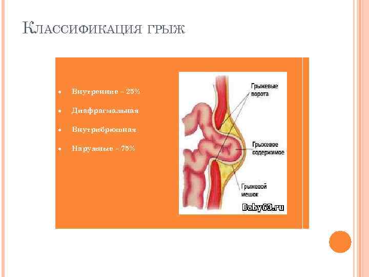 КЛАССИФИКАЦИЯ ГРЫЖ Внутренние – 25% Диафрагмальная Внутрибрюшная Наружные – 75% 