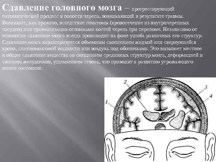 Сдавление головного мозга – прогрессирующий патологический процесс в полости черепа, возникающий в результате травмы.