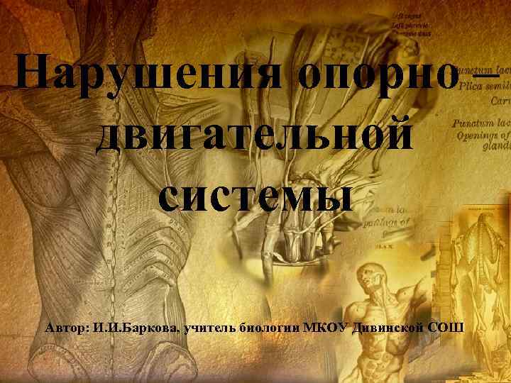 Нарушения опорно – двигательной системы Автор: И. И. Баркова, учитель биологии МКОУ Дивинской СОШ