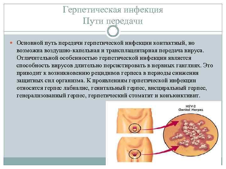 Герпетическая инфекция Пути передачи Основной путь передачи герпетической инфекции контактный, но возможна воздушно-капельная и