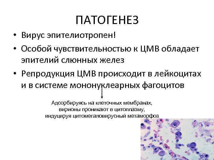 ПАТОГЕНЕЗ • Вирус эпителиотропен! • Особой чувствительностью к ЦМВ обладает эпителий слюнных желез •