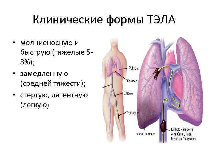 Тромбоэмболические осложнения в послеоперационном периоде