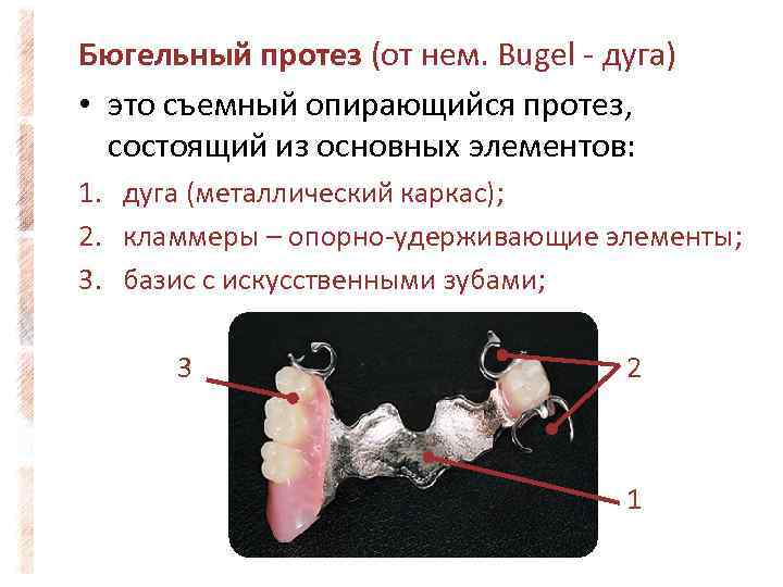 Бюгельные протезы презентация