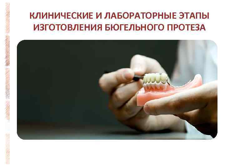 КЛИНИЧЕСКИЕ И ЛАБОРАТОРНЫЕ ЭТАПЫ ИЗГОТОВЛЕНИЯ БЮГЕЛЬНОГО ПРОТЕЗА 