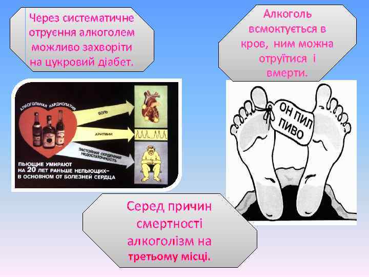 Через систематичне отруєння алкоголем можливо захворіти на цукровий діабет. Серед причин смертності алкоголізм на