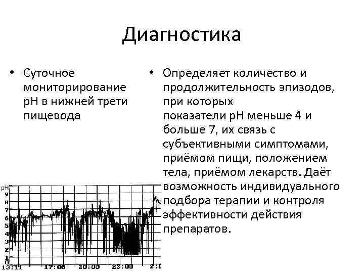 Диагностика • Суточное мониторирование р. Н в нижней трети пищевода • Определяет количество и