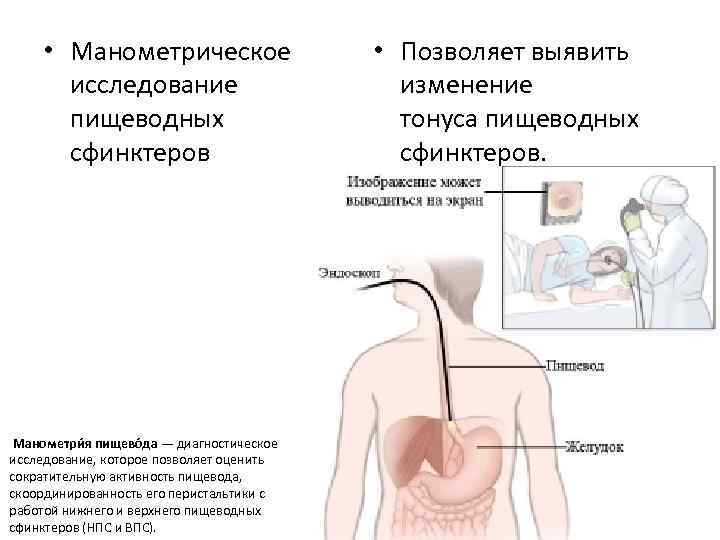 Манометрия сфинктера. Внутрипищеводная манометрия. Манометрические методы исследования. Манометрия пищевода. Манометрическое исследование пищеводных сфинктеров.