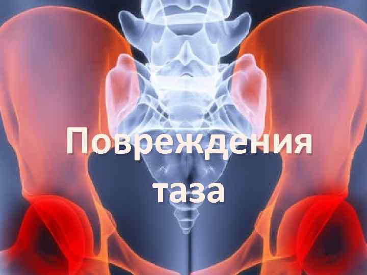 Травмы таза презентация. Повреждения таза презентация. Повреждения мягких тканей таза.