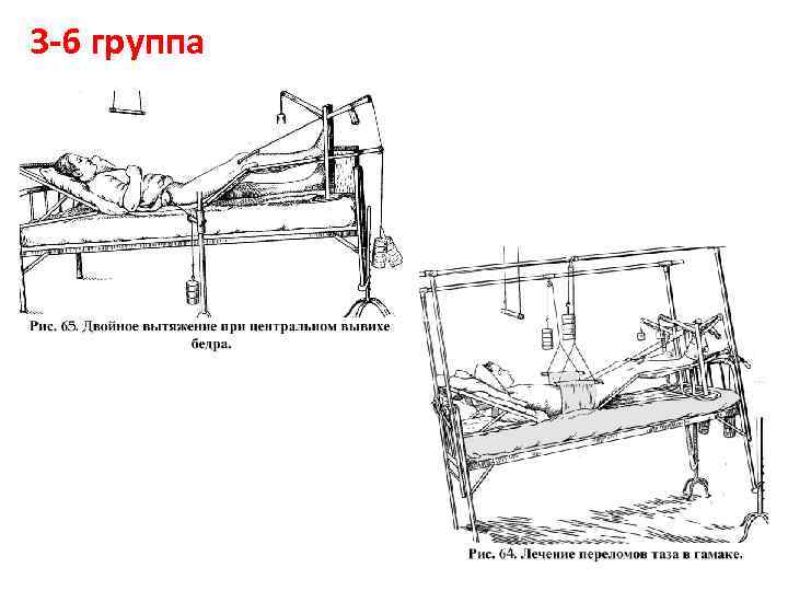 3 6 группа 