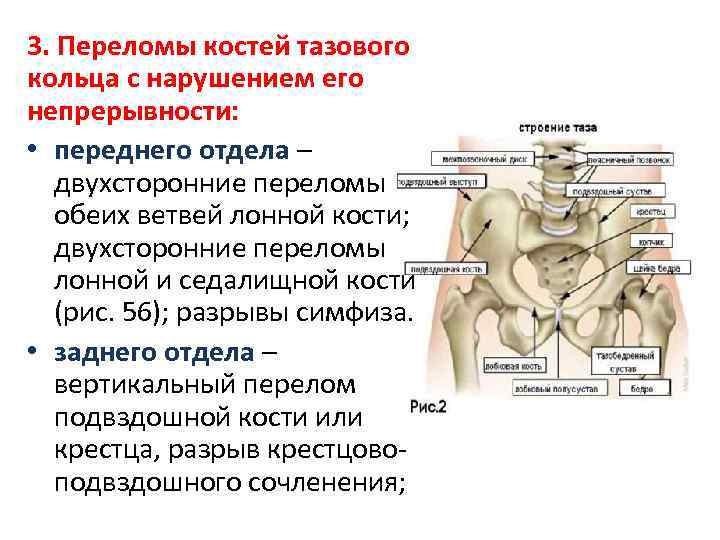 Тазовые кости женщины фото