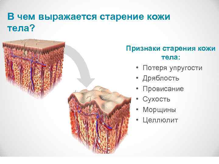 В чем выражается старение кожи тела? Признаки старения кожи тела: • Потеря упругости •