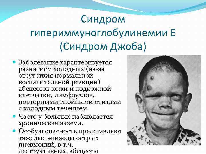 Синдром гипериммуноглобулинемии Е (Синдром Джоба) Заболевание характеризуется развитием холодных (из-за отсутствия нормальной воспалительной реакции)