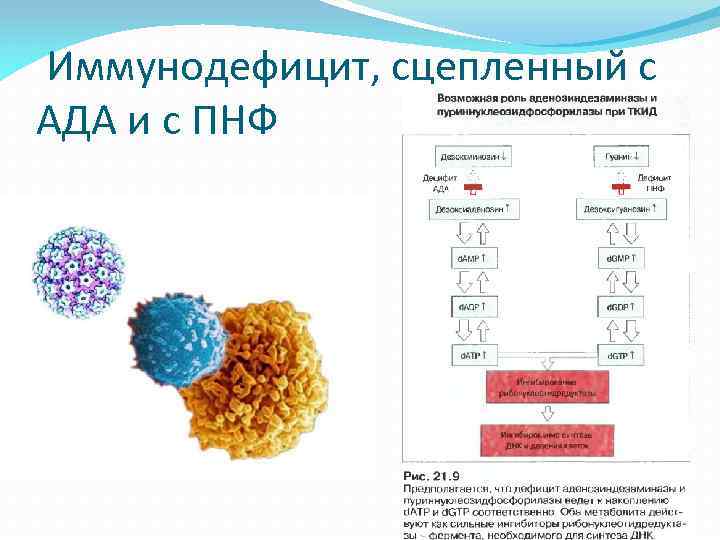  Иммунодефицит, сцепленный с АДА и с ПНФ 