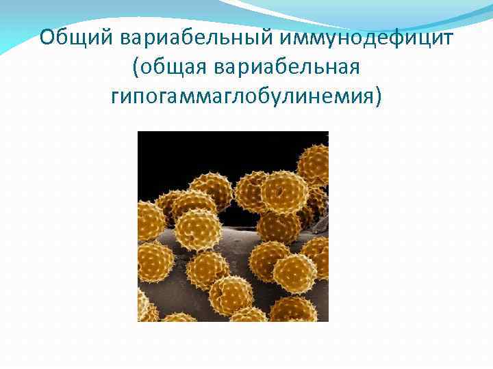 Общий вариабельный иммунодефицит (общая вариабельная гипогаммаглобулинемия) 