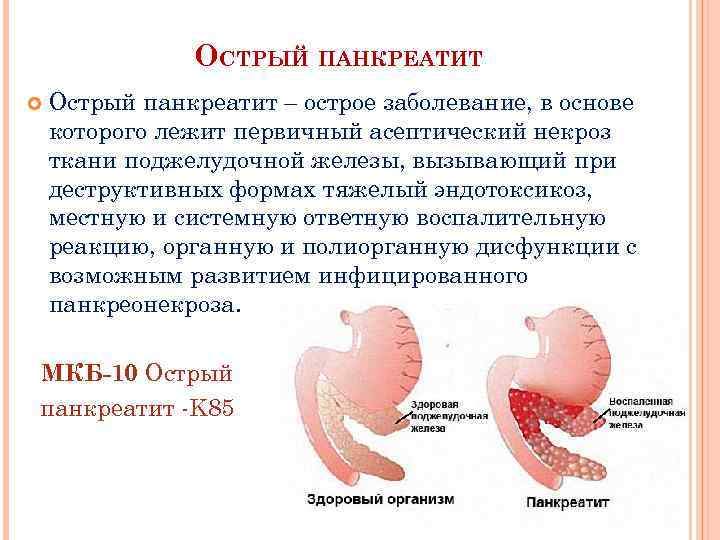 ОСТРЫЙ ПАНКРЕАТИТ Острый панкреатит – острое заболевание, в основе которого лежит первичный асептический некроз