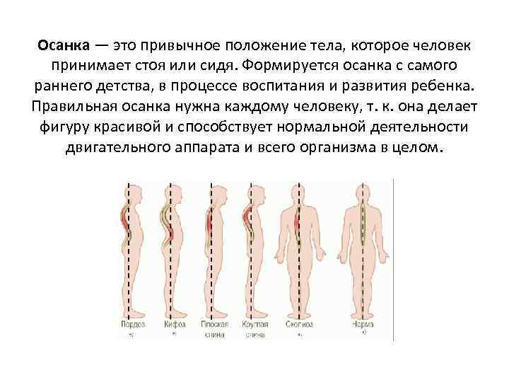 Осанка — это привычное положение тела, которое человек принимает стоя или сидя. Формируется осанка