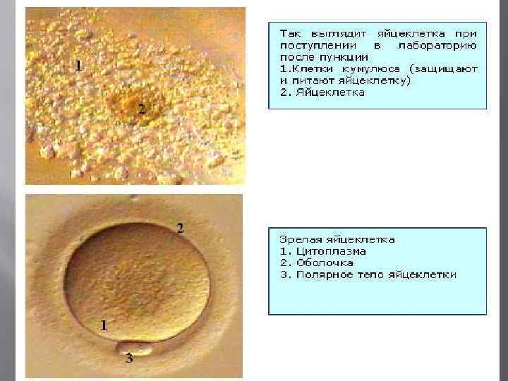 Пункция яйцеклеток это. Преимплантационная генетическая диагностика. Предимплантационная диагностика.