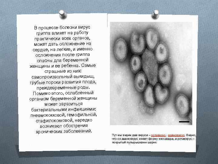 В процессе болезни вирус гриппа влияет на работу практически всех органов, может дать осложнение