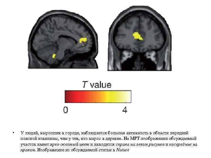  • У людей, выросших в городе, наблюдается большая активность в области передней поясной