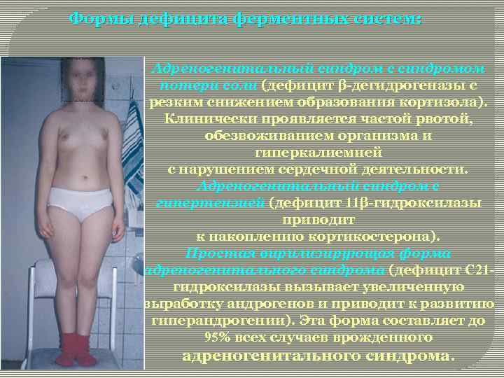 Формы дефицита ферментных систем: Адреногенитальный синдром с синдромом потери соли (дефицит β-дегидрогеназы с резким