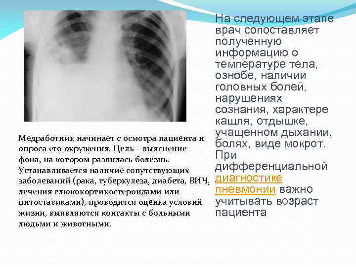 На следующем этапе врач сопоставляет полученную информацию о температуре тела, ознобе, наличии головных болей,