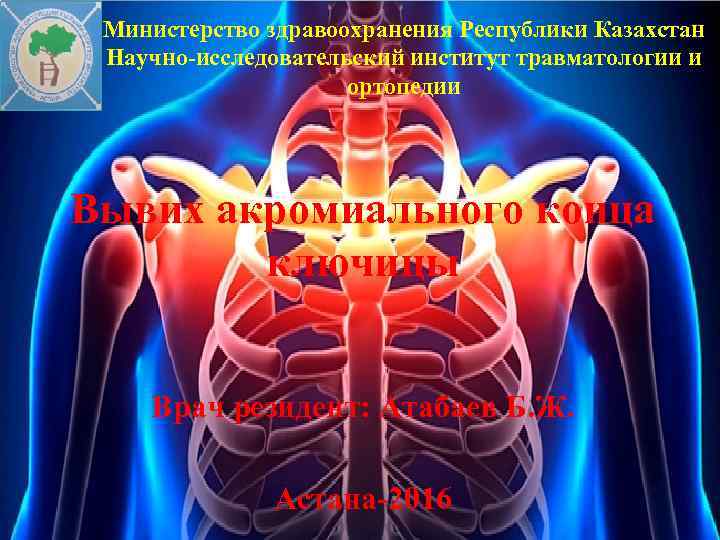 Министерство здравоохранения Республики Казахстан Научно-исследовательский институт травматологии и ортопедии Вывих акромиального конца ключицы Врач